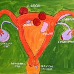 Endometrial evaluation in office - image