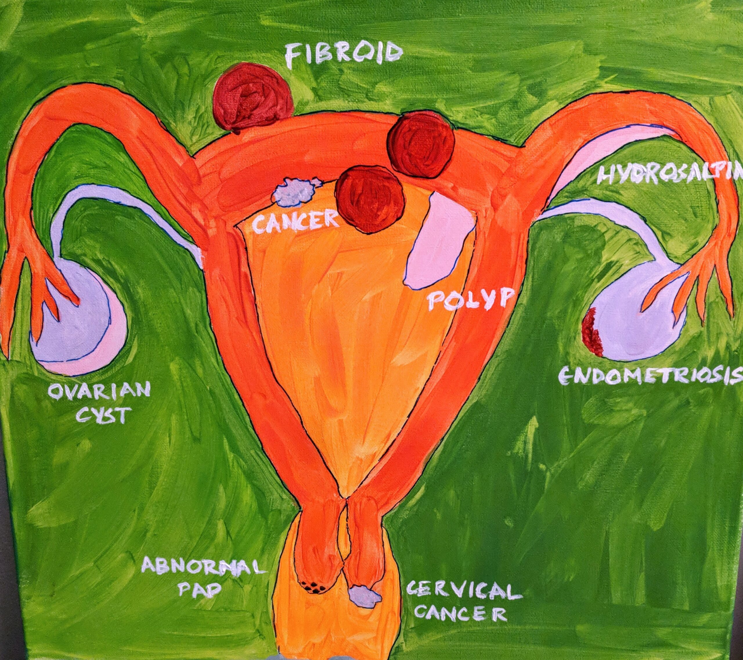 Endometrial evaluation in office - image
